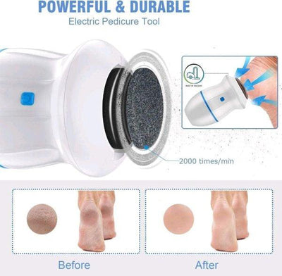 Electric Foot Callus Remover With Built-in Vacuum Style Spectrum