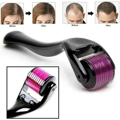 Skin Therapy Derma Roller With 540 Micro Needle Roller For Men And Women Style Spectrum